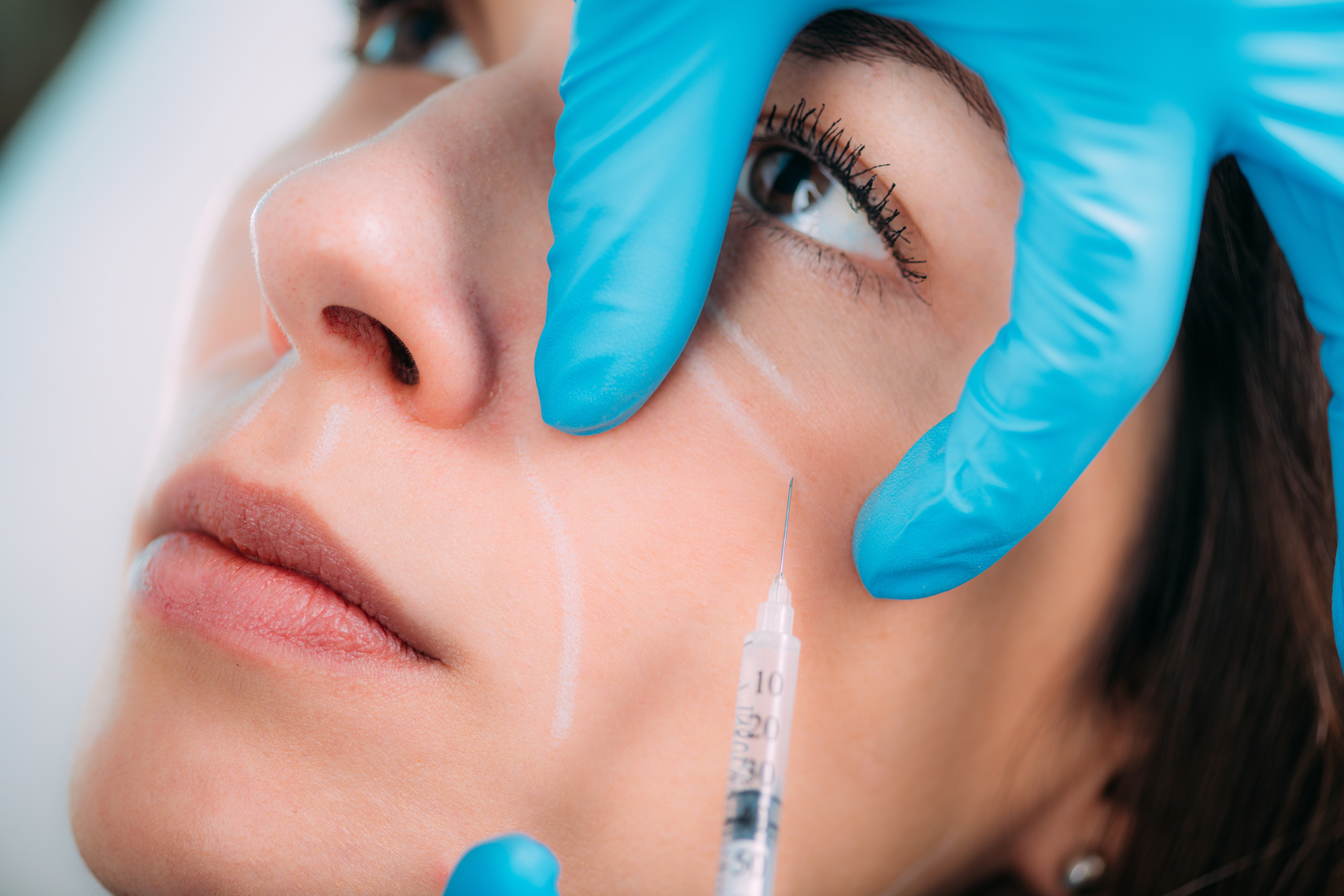 Anti-Aging Treatment. Dermal Filler Injection